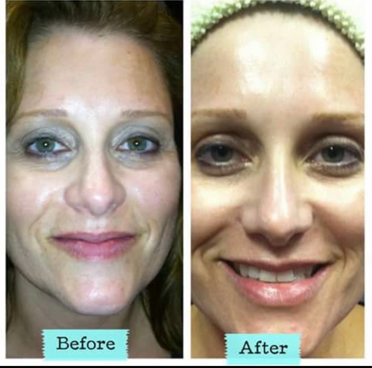 👑 Rashel Miracle Hollywood Anti-Aging Trio