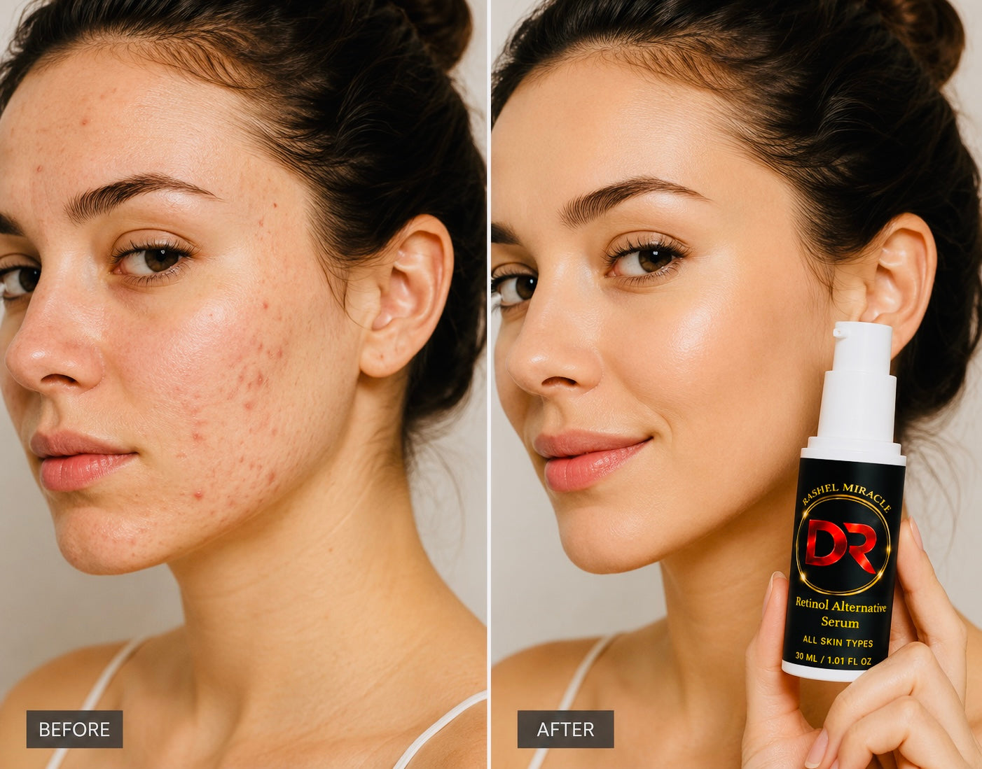 Dr Rashel Miracle Plant-Based Retinol Alternative Serum for Acne-Prone & Problem Skin