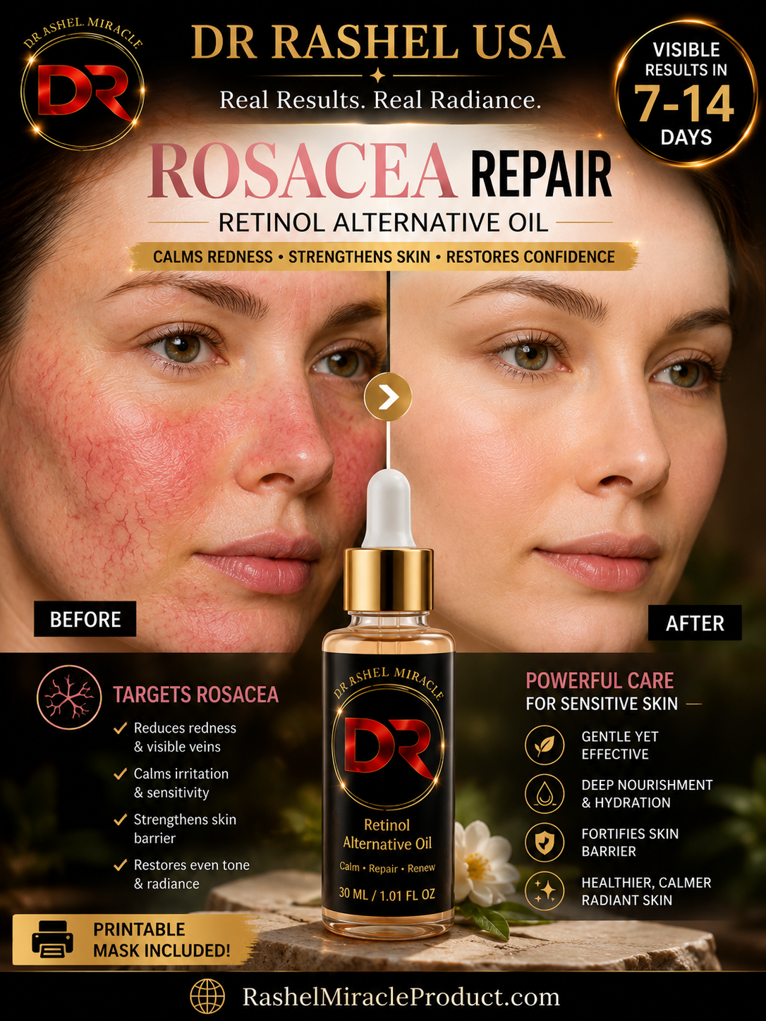Rosacea Repair Retinol Alternative Oil - before and after
