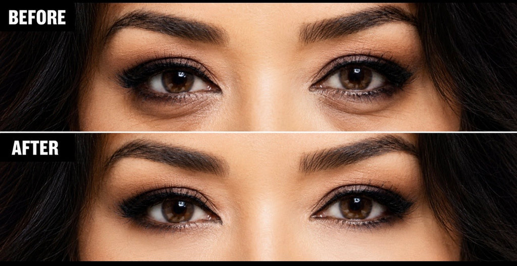 Before and after images showing Rashel Miracle Brightening Eye Serum reducing dark circles and puffiness around the eyes.