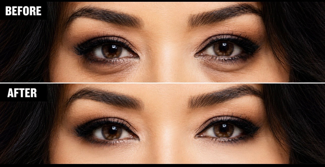 Brightening Eye Serum for Dark Circles & Puffiness